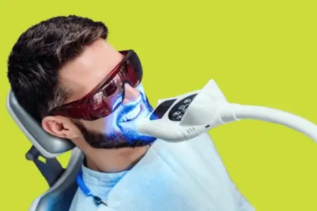 Albire Dentară Timișoara