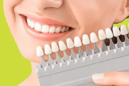 Estetică Dentară Timișoara